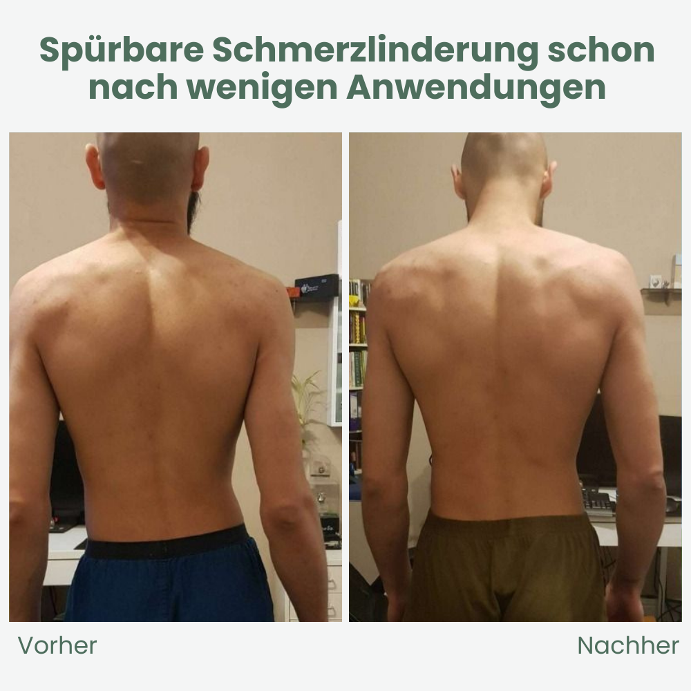 Rückenorthese für Schmerzlinderung und aufrechte Haltung
